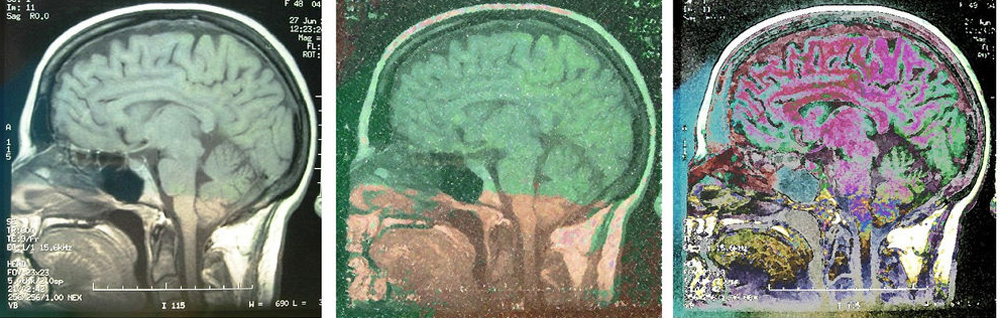 Escaneo cerebral