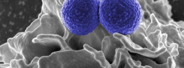Científicos españoles participan en un consorcio internacional para frenar a las bacterias patógenas