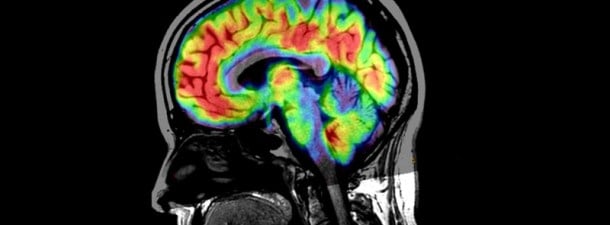 Our brain can cure itself thanks to these biodegradable implants