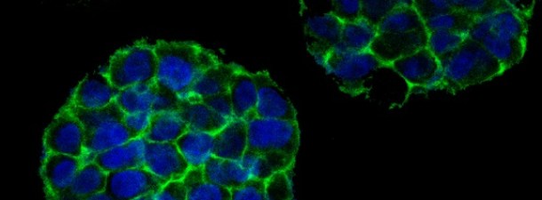 3D printing of tumours: the latest revolution in the study of cancer