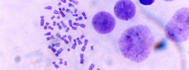 Una empresa española, pionera en medir tu “verdadera edad biológica”
