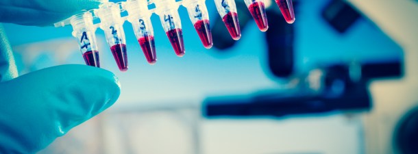 El fin del Ébola está cada vez más cerca gracias a dos nuevos fármacos