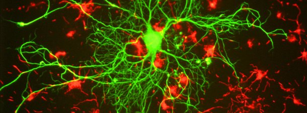 Las primeras neuronas artificiales de cambio de fase nos acercan al cerebro robótico
