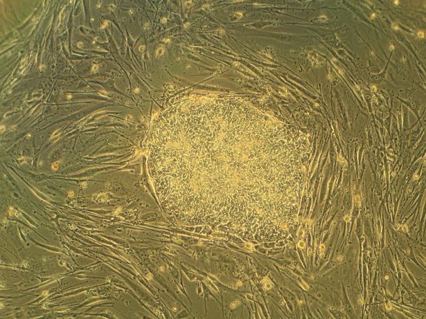 células madre