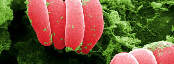 Un test para detectar la anemia basado en la impresión 3D