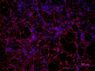 neuronas