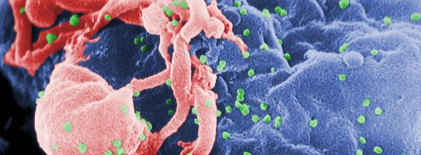 La cura del VIH cada vez más cerca gracias a la técnica CRISPR-Cas9