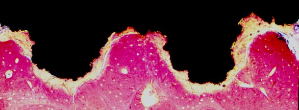 Crean el material más duro del mundo compatible con tejidos humanos