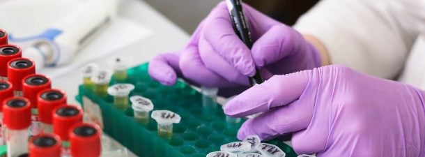Una nueva terapia personalizada para el cáncer de páncreas metastásico