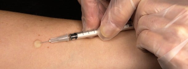 El virus de China: ¿qué es, cómo avanza y qué precauciones se deben tomar?