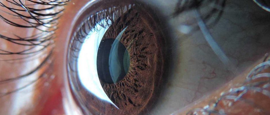 Diagnóstico oftalmológico en tiempo real por 5G utilizando tecnología de la Fórmula 1