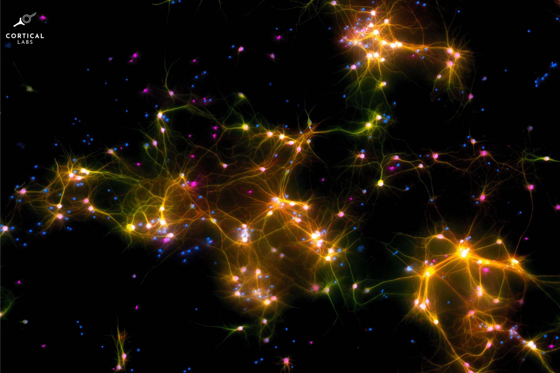 Ordenadores con neuronas y su papel en la inteligencia artificial