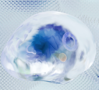 implantes cerebrales para recuperar el habla
