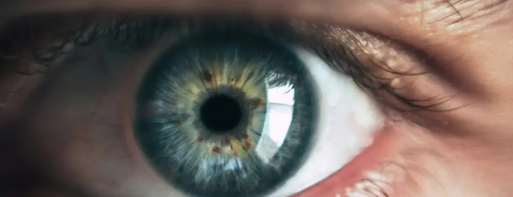 Ojo