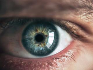 Ojo