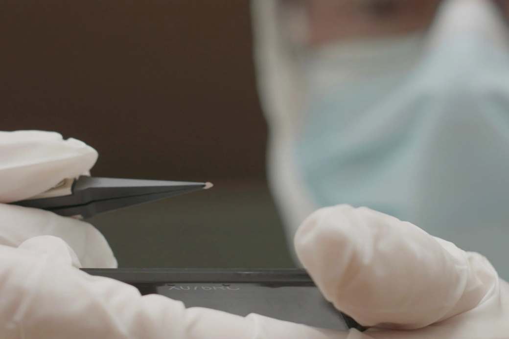 Implante y gafas PRIMA para recuperar la vista perdida por degeneración macular